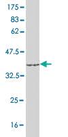 Anti-ACSL1 Mouse Monoclonal Antibody [clone: 3G4]