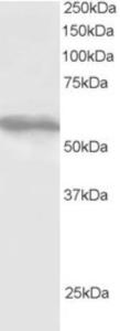 EB05931 staining (1µg/ml) of HepG2 lysate (RIPA buffer, 30µg total protein per lane).  Primary incubated for 1 hour.  Detected by western blot using chemiluminescence.