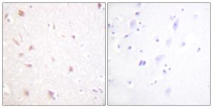 Immunohistochemical analysis of paraffin-embedded human brain tissue using Anti-NIFK Antibody. The right hand panel represents a negative control, where the antibody was pre-incubated with the immunising peptide.