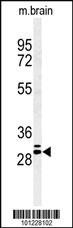 Anti-GJB2 Rabbit Polyclonal Antibody