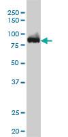 Anti-CSE1L Mouse Monoclonal Antibody [clone: 3F8]