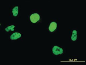 Anti-SMARCB1 Mouse Polyclonal Antibody