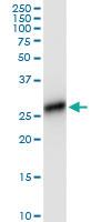 Anti-HLA-DRB4 Mouse Monoclonal Antibody [clone: 4C8]