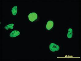 Anti-SMARCB1 Mouse Polyclonal Antibody