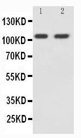 Anti-NMDAR1 Rabbit Polyclonal Antibody