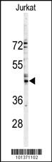 Anti-GJA3 Rabbit Polyclonal Antibody