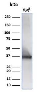 Western blot analysis of Raji cell line lysate using Anti-CD20 Antibody [IGEL/6850R]