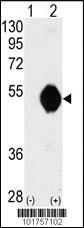 Anti-DOK2 Rabbit Polyclonal Antibody