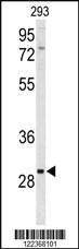 Anti-SIRT3 Rabbit Polyclonal Antibody