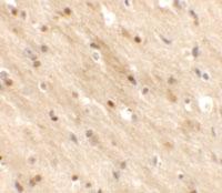 Anti-TMEM59L Rabbit Polyclonal Antibody