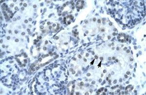 Anti-PAX2 Rabbit Polyclonal Antibody