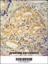 Anti-CP013 Rabbit Polyclonal Antibody (HRP (Horseradish Peroxidase))