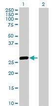 Anti-HLA-DRB5 Mouse Polyclonal Antibody