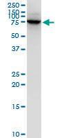 Anti-LIMK1 Mouse Monoclonal Antibody [clone: 1A8]