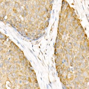 Anti-Hsp90 beta Rabbit Polyclonal Antibody