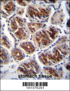 Anti-GJA4 Rabbit Polyclonal Antibody