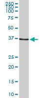 Anti-SMARCB1 Rabbit Polyclonal Antibody