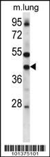 Anti-GJA4 Rabbit Polyclonal Antibody