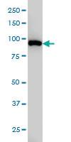 Anti-CSE1L Mouse Monoclonal Antibody [clone: 1C4]