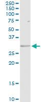 Anti-HLA-DRB5 Rabbit Polyclonal Antibody