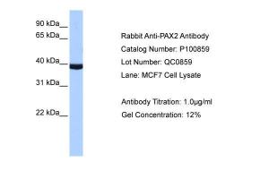 Anti-PAX2 Rabbit Polyclonal Antibody