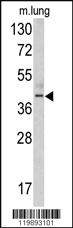 Anti-TDG Rabbit Polyclonal Antibody