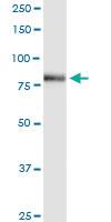 Anti-ACSL3 Polyclonal Antibody Pair