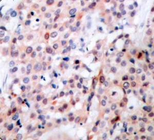 Anti-Bcl-2 Rabbit Polyclonal Antibody