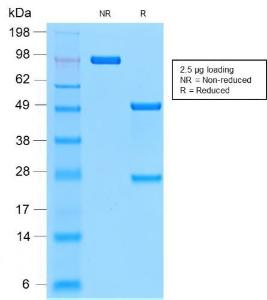 SDS-PAGE analysis of Anti-CD44v9 Antibody [CD44v9/2344R] under non-reduced and reduced conditions; showing intact IgG and intact heavy and light chains, respectively. SDS-PAGE analysis confirms the integrity and purity of the antibody.