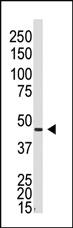 Anti-GJA5 Rabbit Polyclonal Antibody