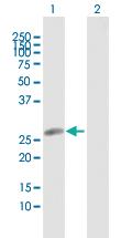 Anti-HLA-DRB5 Rabbit Polyclonal Antibody