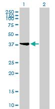 Anti-STYK1 Mouse Monoclonal Antibody [clone: 3A8]