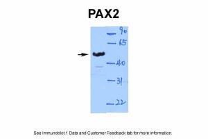 Anti-PAX2 Rabbit Polyclonal Antibody