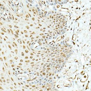 Anti-Hsp90 beta Rabbit Polyclonal Antibody