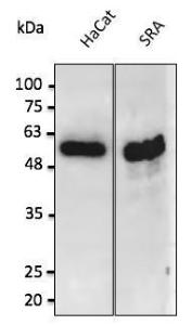 Anti-p53 antibody