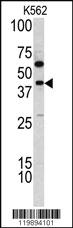 Anti-TDG Rabbit Polyclonal Antibody