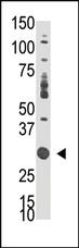 Anti-DOK5 Rabbit Polyclonal Antibody