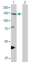 Anti-EIF4ENIF1 Rabbit Polyclonal Antibody