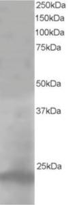 EB05946 staining (1µg/ml) of A431 lysate (RIPA buffer, 35µg total protein per lane).  Primary incubated for 1 hour.  Detected by western blot using chemiluminescence.