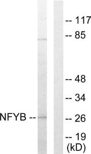 Western blot analysis of lysates from 293 cells using Anti-NFYB Antibody. The right hand lane represents a negative control, where the Antibody is blocked by the immunising peptide