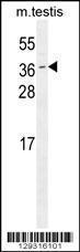 Anti-ODF3 Rabbit Polyclonal Antibody