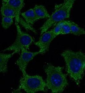 Anti-p53 antibody