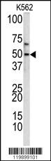 Anti-KLF11 Rabbit Polyclonal Antibody