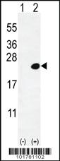 Anti-DOK5 Rabbit Polyclonal Antibody