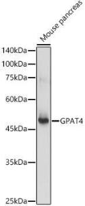 Western blot analysis of extracts of Mouse pancreas, using Anti-GPAT4 Antibody (A305880) at 1:1,000 dilution. The secondary antibody was Goat Anti-Rabbit IgG H&L Antibody (HRP) at 1:10,000 dilution.