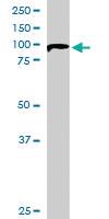 Anti-OSBPL11 Goat Polyclonal Antibody