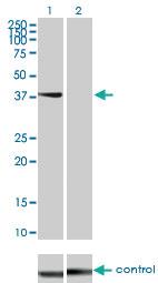 Anti-STYK1 Mouse Monoclonal Antibody [clone: 3A8]