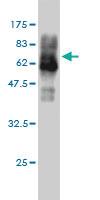 Anti-CAMK4 Mouse Monoclonal Antibody [clone: 1A3]