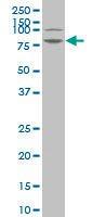 Anti-LIMK1 Mouse Monoclonal Antibody [clone: 2E9]