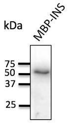 Anti-Insulin Antibody at a 1:1000 dilution, 20ng of recombinant protein, and rabbit anti-goat IgG antibody (HRP) at a 1:10000 dilution